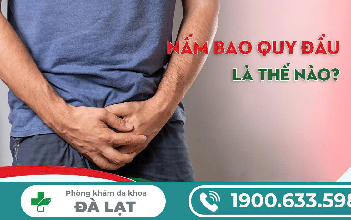 Hình ảnh minh họa